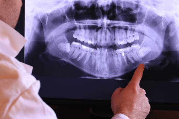 Best Emergency Dental Surgery in Mena, AR